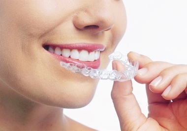 アライナー矯正中の「食べ物・飲み物」に関する注意点